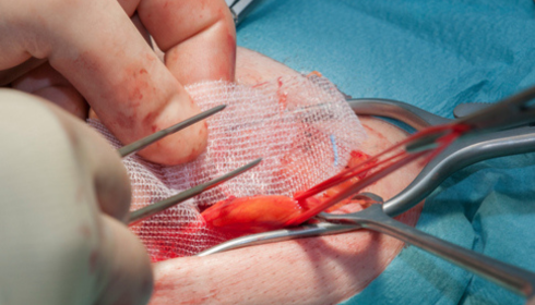 Inside the Operating Room: Where Everyday Surgery Quietly Changes Lives